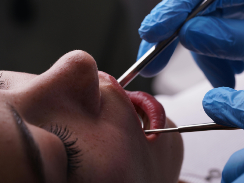 Popular Dental Treatments Explained