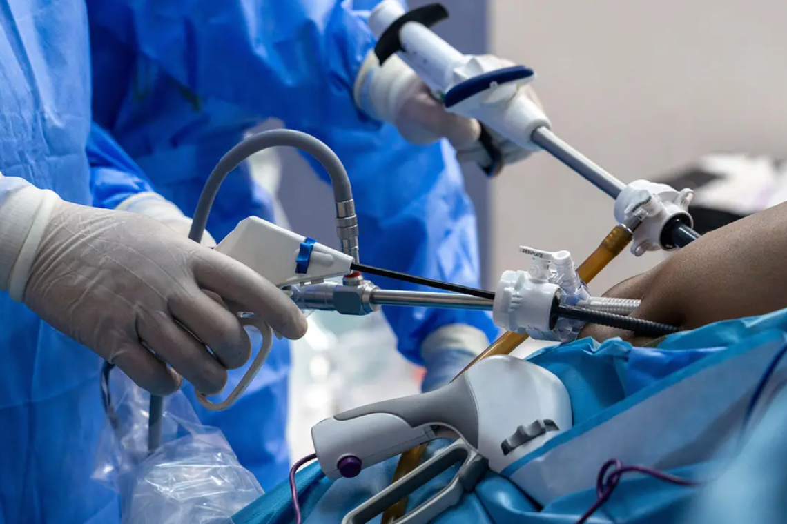 Gastric Sleeve Treatments